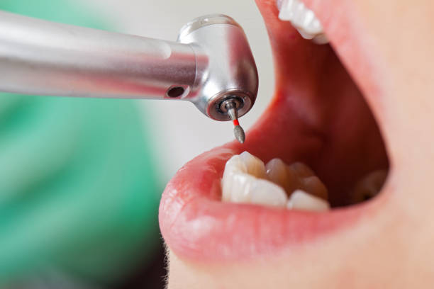 Best Broken or Cracked Tooth Emergency Dentist in Mastic, NY